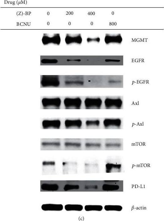Detection of Human Axl by Western Blot
