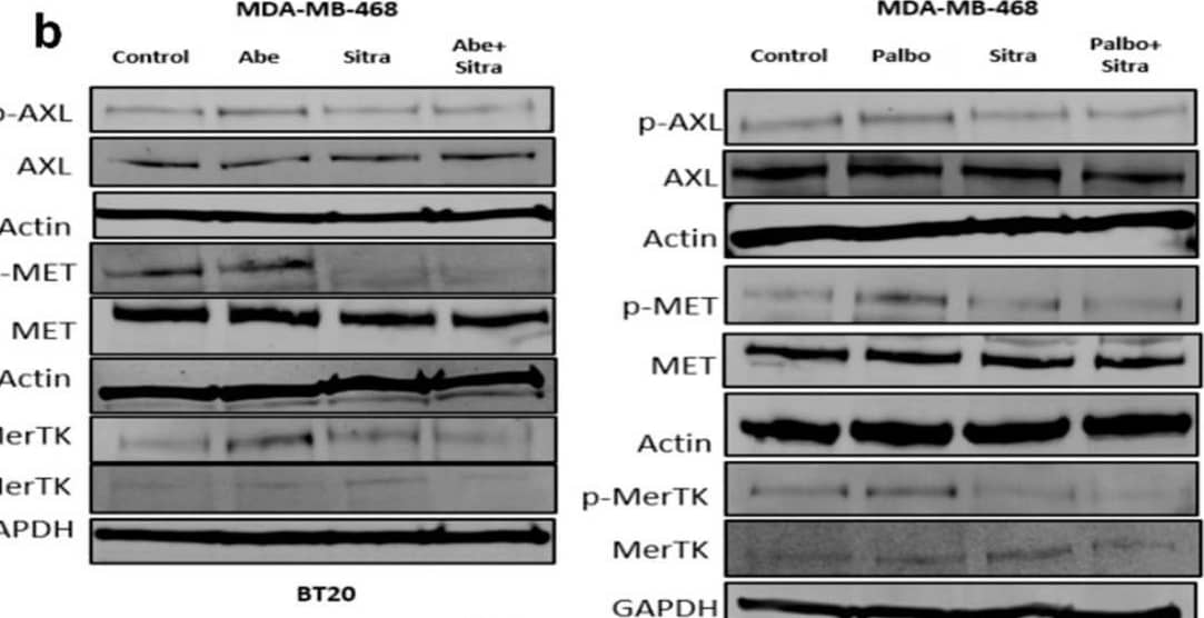 Detection of Phospho-Axl (Y779) by Western Blot