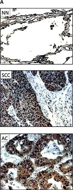 Detection of Human CXCR6 by Immunocytochemistry/Immunofluorescence