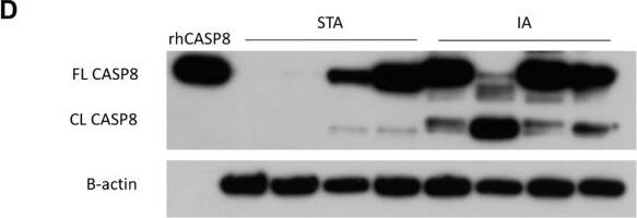 Detection of Caspase-8 by Western Blot