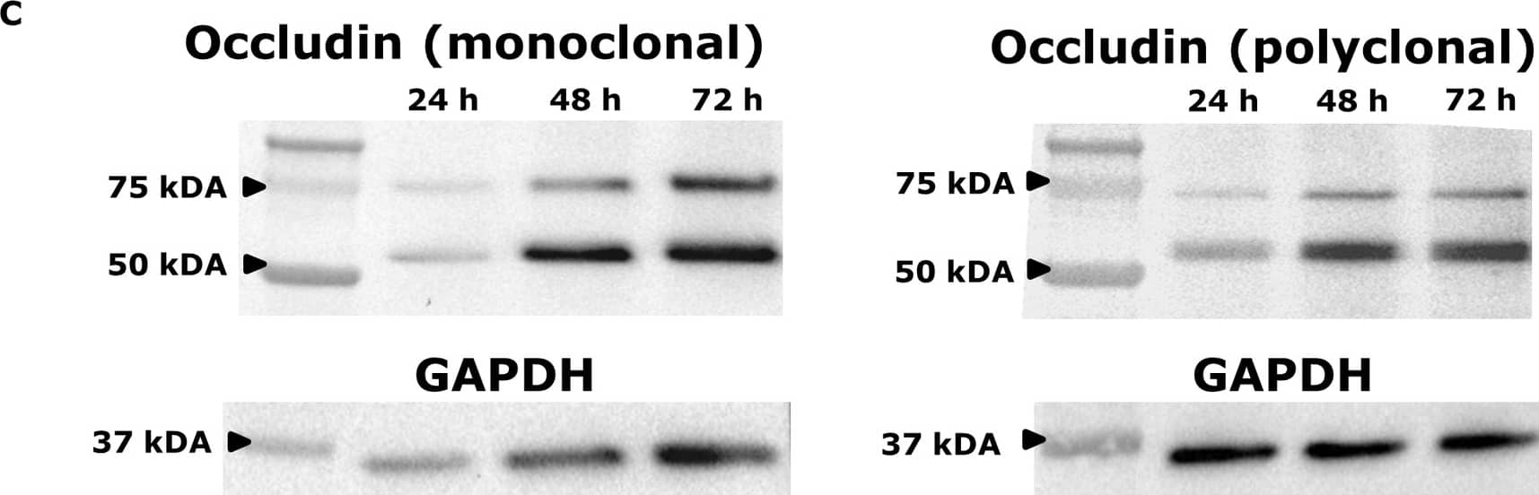 Detection of Human Occludin by Western Blot
