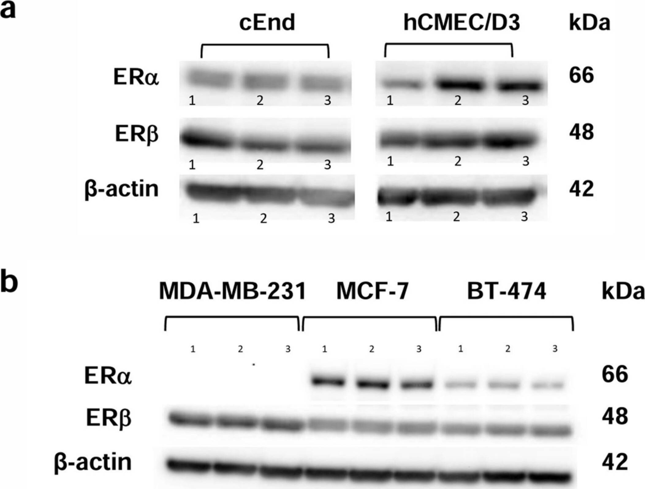 Detection of ER beta/NR3A2 by Western Blot