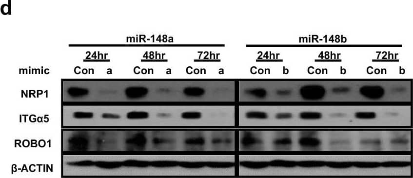 Detection of Human ROBO1 by Western Blot