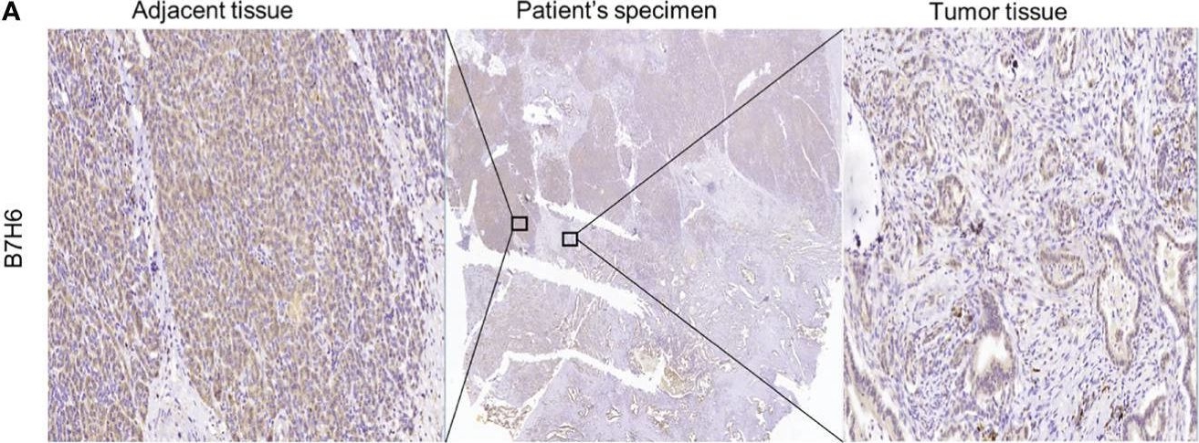 Detection of Human B7-H6 by Immunohistochemistry