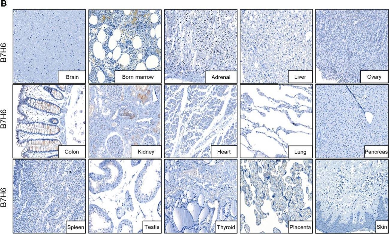 Detection of Human B7-H6 by Immunohistochemistry