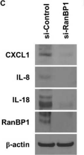 Detection of IL-8/CXCL8 by Western Blot