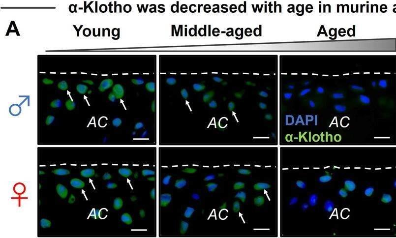 Detection of Klotho by Immunocytochemistry/ Immunofluorescence