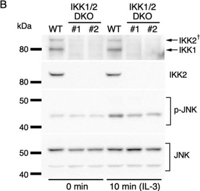Detection of IKK beta by Western Blot