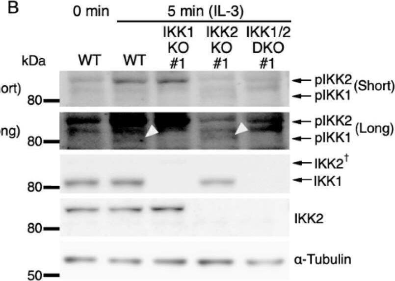 Detection of IKK beta by Western Blot