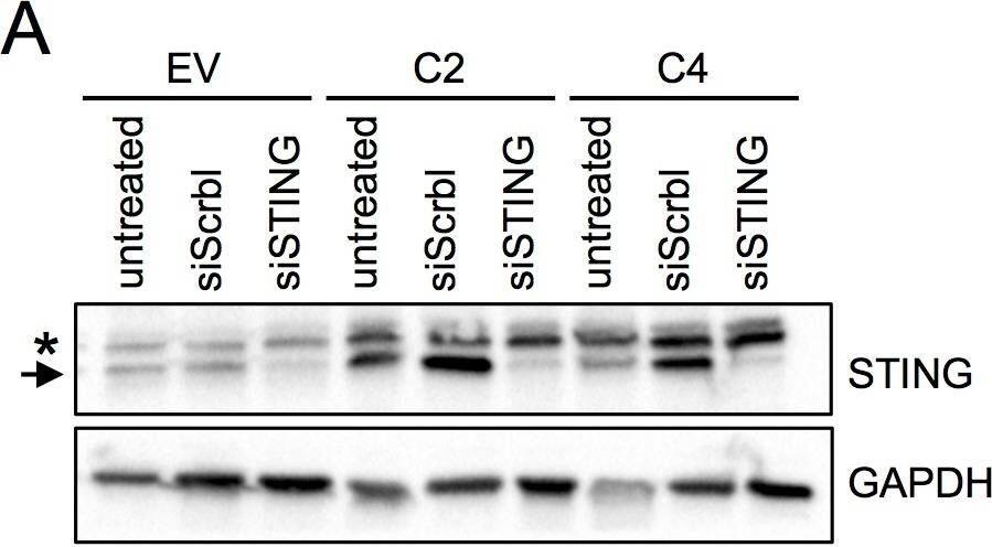 Detection of Human STING/TMEM173 by Western Blot