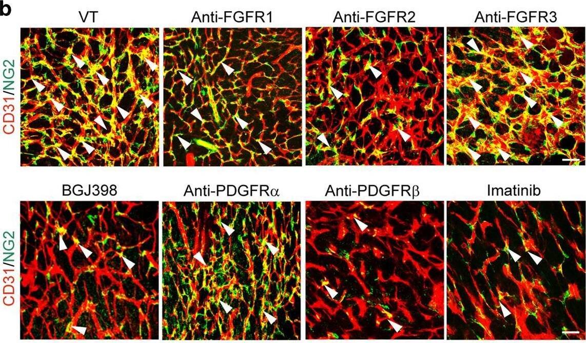 Detection of Mouse FGFR2 (IIIc) by Immunohistochemistry