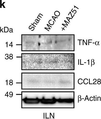Detection of CCL28 by Western Blot