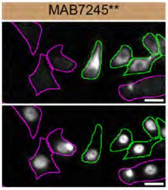 Rab27a Specificity is Shown by Immunocytochemistry in Knockdown Cell Line.