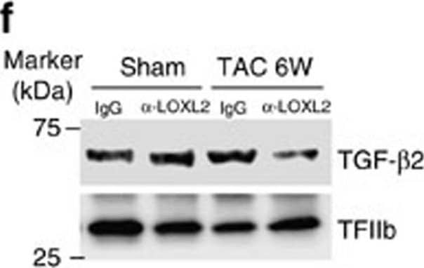 Mouse TGF-beta 2 Antibody (MAB73461) | Bio-Techne