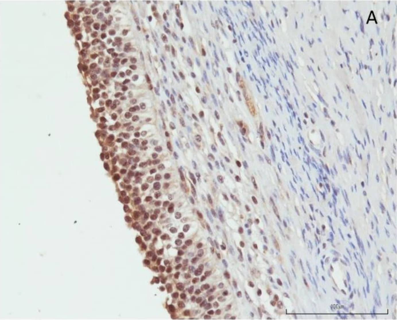 Detection of Porcine Orexin B/Hypocretin-2 by Immunohistochemistry