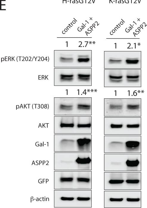 Detection of Human AKT1 by Western Blot