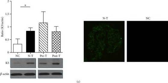 Detection of Mouse Plasminogen Kringle 5 by Western Blot