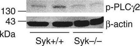 Detection of Mouse PLC-gamma 1 by Western Blot