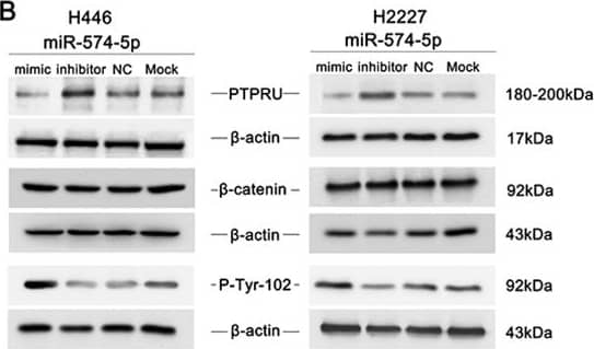 Detection of Human PTP pi/PTPRU by Western Blot