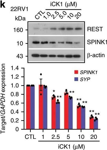 Detection of Human SPINK1 by Western Blot Detection of Human SPINK1 by Western Blot