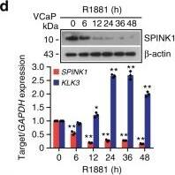 Detection of Human SPINK1 by Western Blot Detection of Human SPINK1 by Western Blot