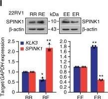 Detection of Human SPINK1 by Western Blot Detection of Human SPINK1 by Western Blot