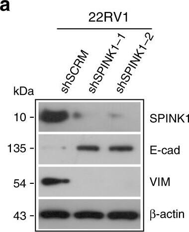 Detection of Human SPINK1 by Western Blot Detection of Human SPINK1 by Western Blot