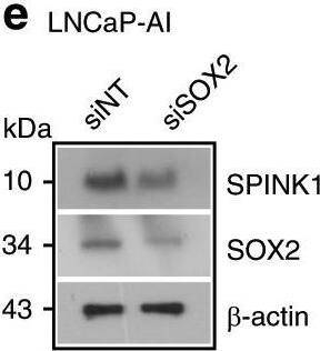 Detection of Human SPINK1 by Western Blot Detection of Human SPINK1 by Western Blot
