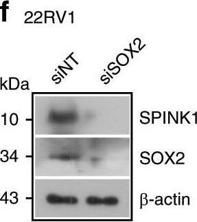 Detection of Human SPINK1 by Western Blot Detection of Human SPINK1 by Western Blot