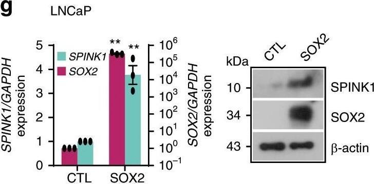 Detection of Human SPINK1 by Western Blot Detection of Human SPINK1 by Western Blot