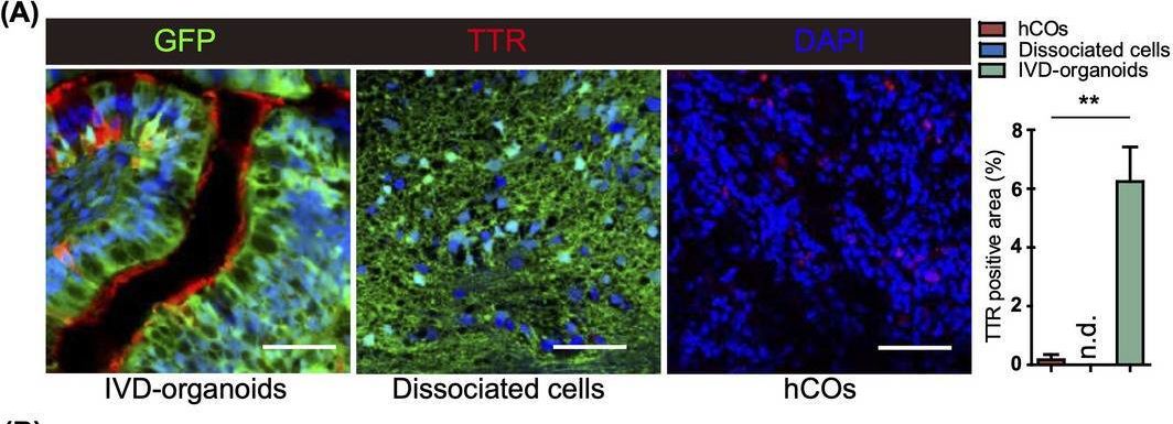 Detection of Transthyretin/Prealbumin by Immunohistochemistry