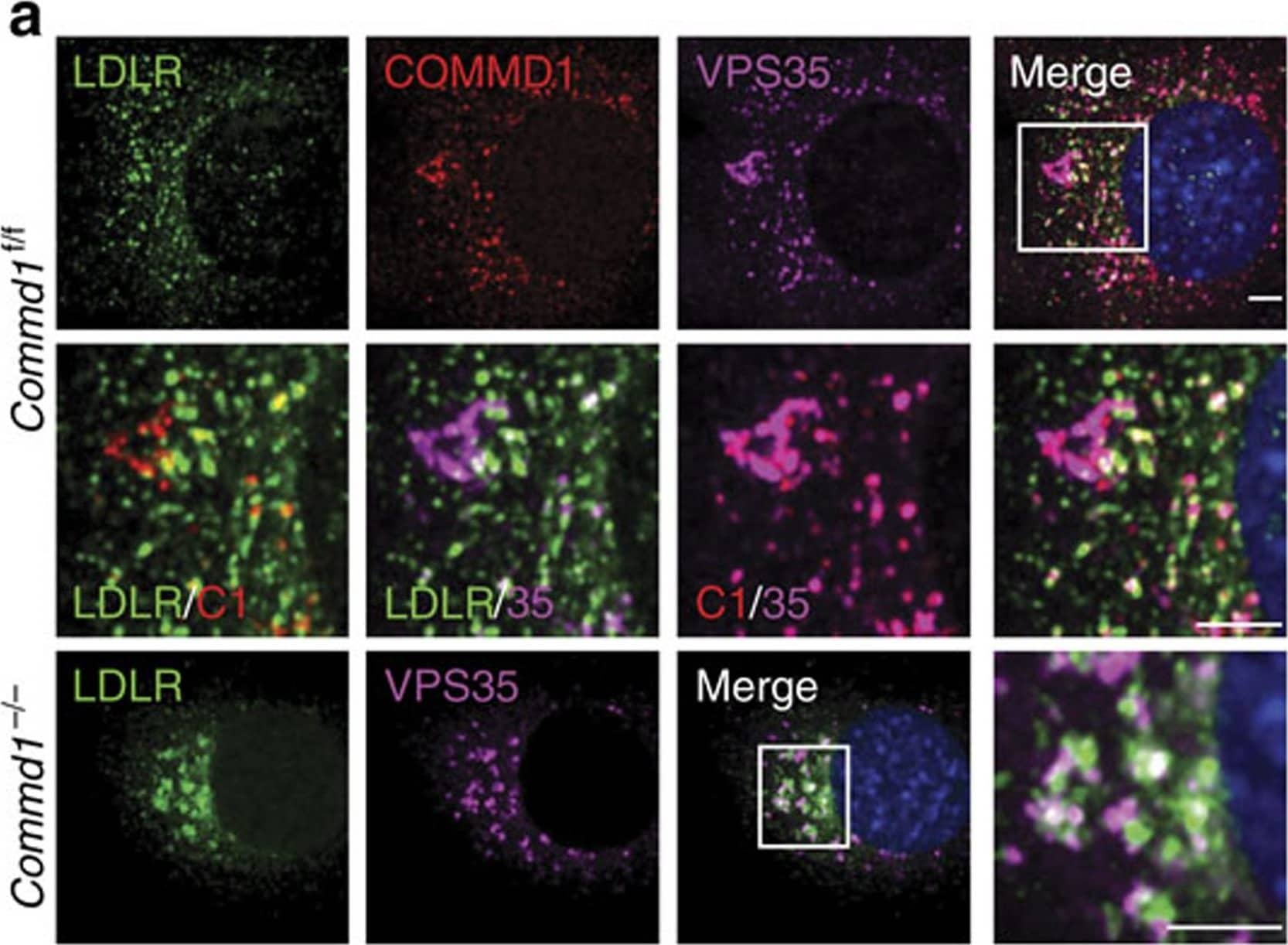 Detection of Mouse COMMD1 by Immunocytochemistry/Immunofluorescence