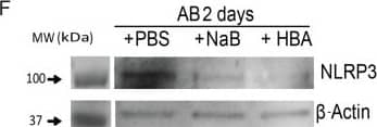 Detection of Mouse NLRP3/NALP3 by Western Blot