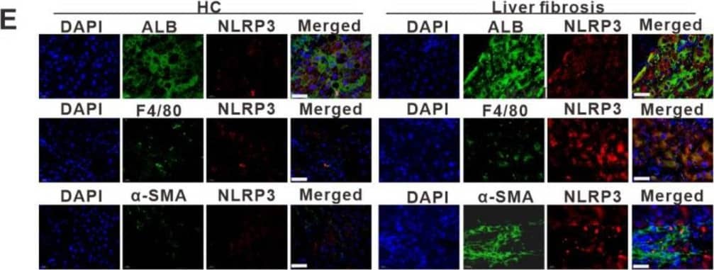 Detection of Human NLRP3/NALP3 by Immunohistochemistry