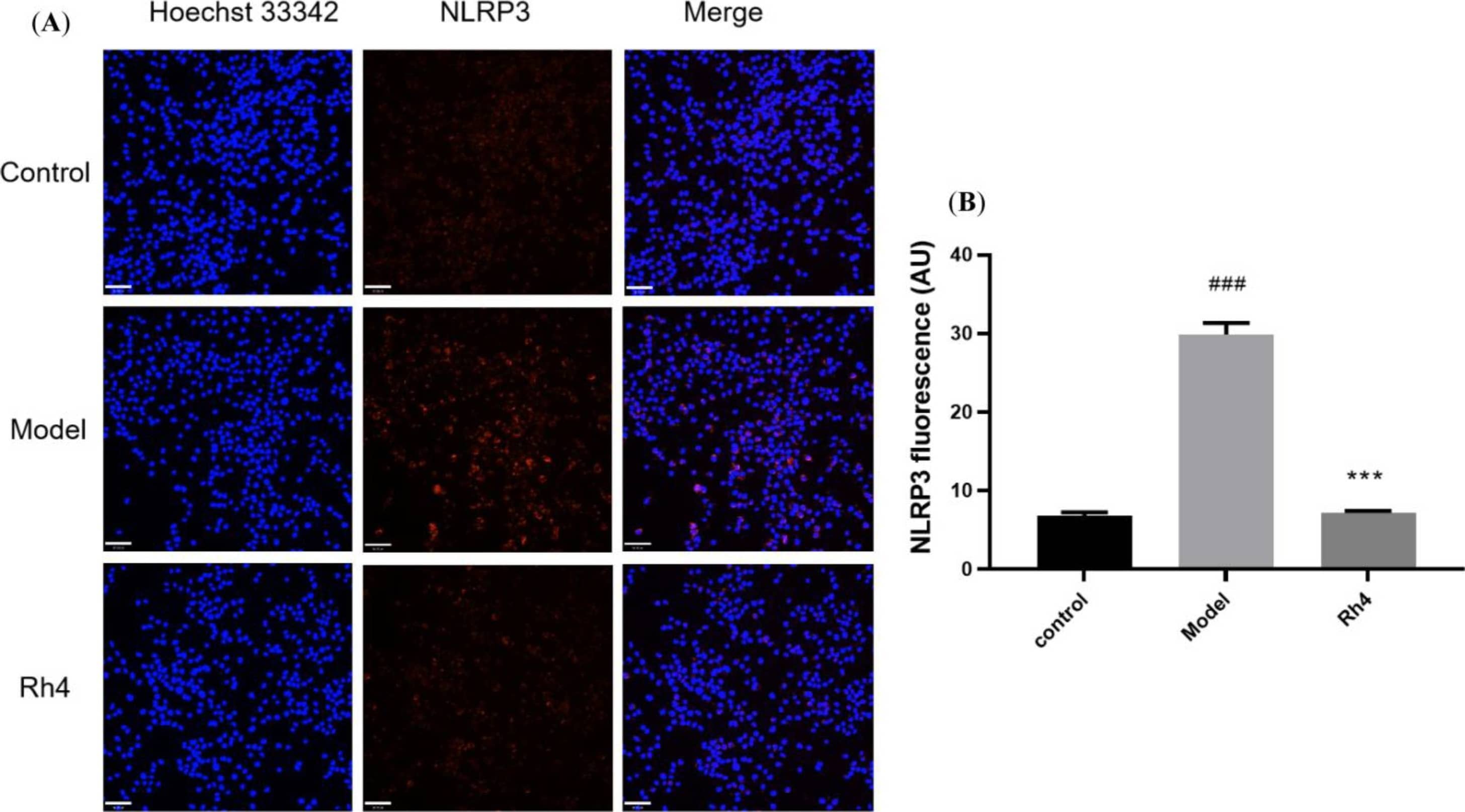 Detection of NLRP3/NALP3 by Immunocytochemistry/ Immunofluorescence