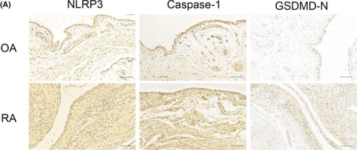 Detection of Human NLRP3/NALP3 by Immunohistochemistry