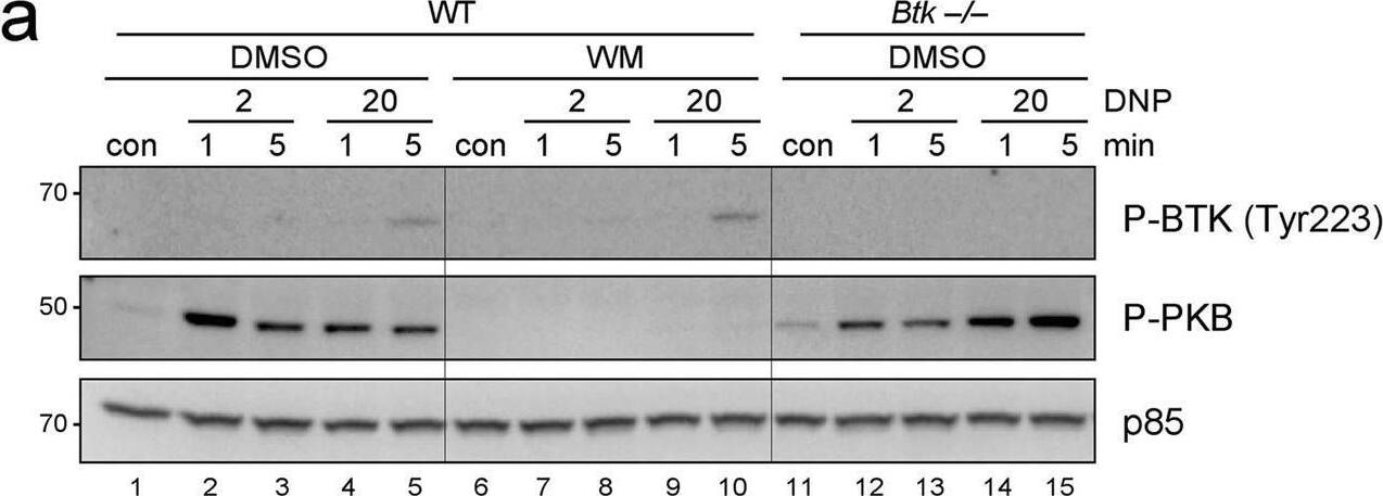 Detection of Phospho-BTK (Y551) by Western Blot