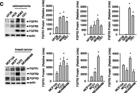 Detection of Human FGFR1 by Western Blot