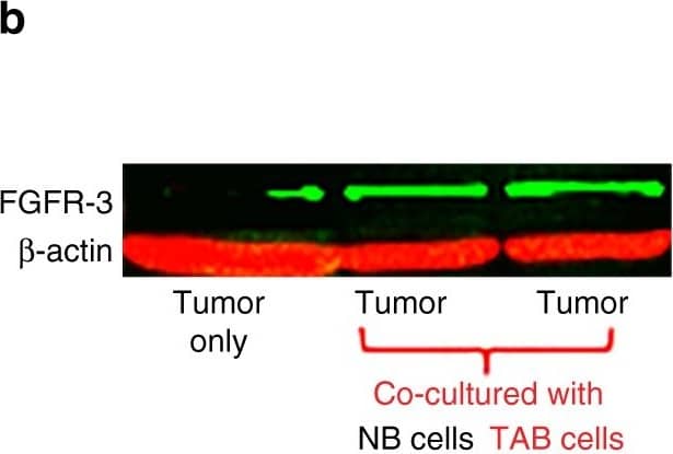 Detection of Mouse FGFR3 by Western Blot