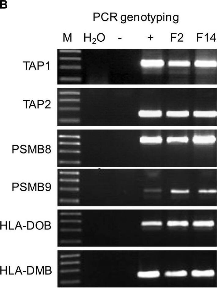 Detection of LMP2/PSMB9 by Western Blot
