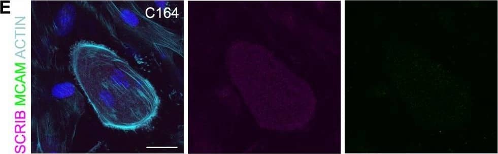 Detection of Mouse MCAM/CD146 by Immunocytochemistry/Immunofluorescence