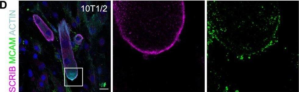 Detection of Mouse MCAM/CD146 by Immunocytochemistry/Immunofluorescence