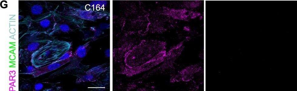 Detection of Mouse MCAM/CD146 by Immunocytochemistry/Immunofluorescence