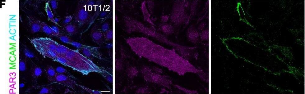 Detection of Mouse MCAM/CD146 by Immunocytochemistry/Immunofluorescence