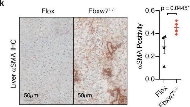 Detection of brqg9ujed6vbcpgfvygo.jpg by Immunohistochemistry