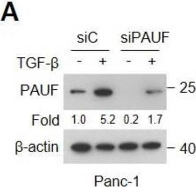 Detection of PAUF/ZG16B by Western Blot