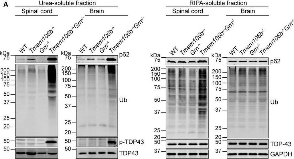 Detection of Mouse TDP-43/TARDBP by Western Blot