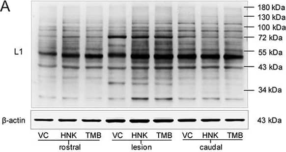 Detection of Mouse L1CAM by Western Blot