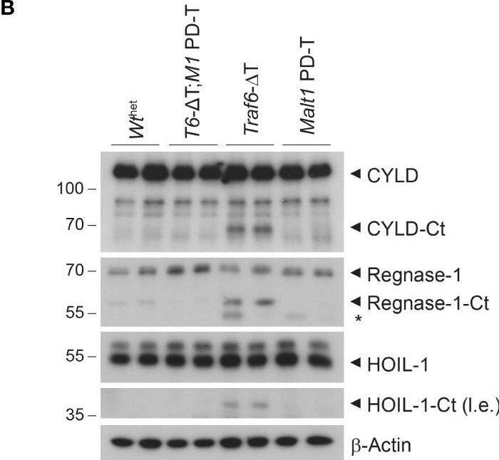 Detection of Mouse MCPIP1 by Western Blot