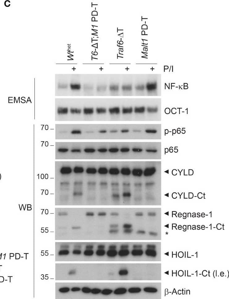 Detection of Mouse MCPIP1 by Western Blot